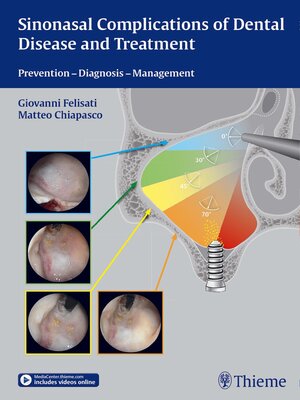 cover image of Sinonasal Complications of Dental Disease and Treatment